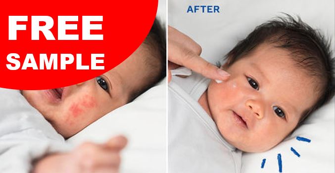 free mustela eczema sample